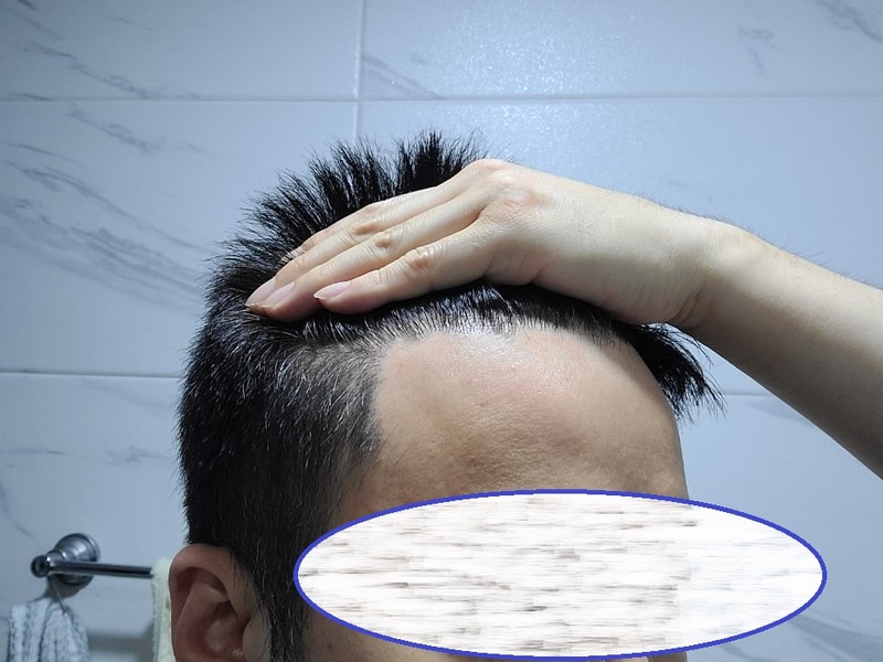 M-shaped 3300 mother 1 year and 6 months have passed