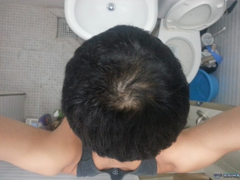 벌린거.jpg