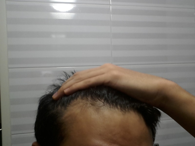 오른쪽.jpg