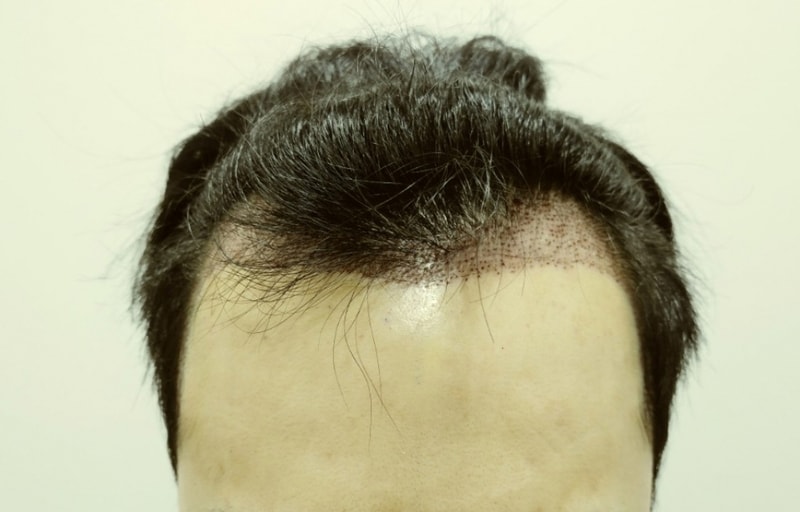 정면2.jpg