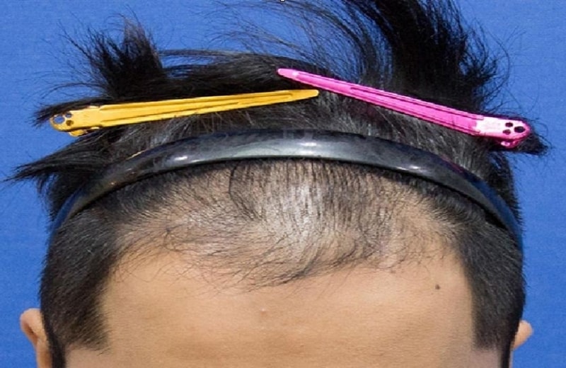 1.JPG