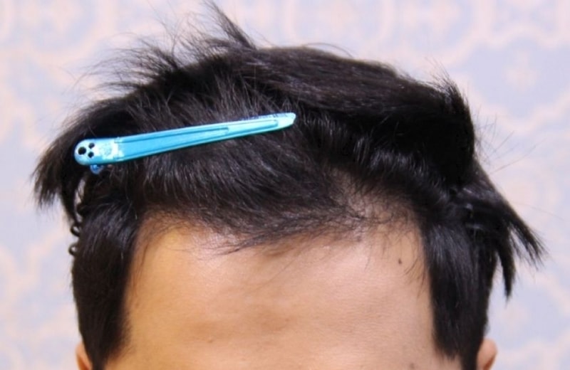 2.JPG
