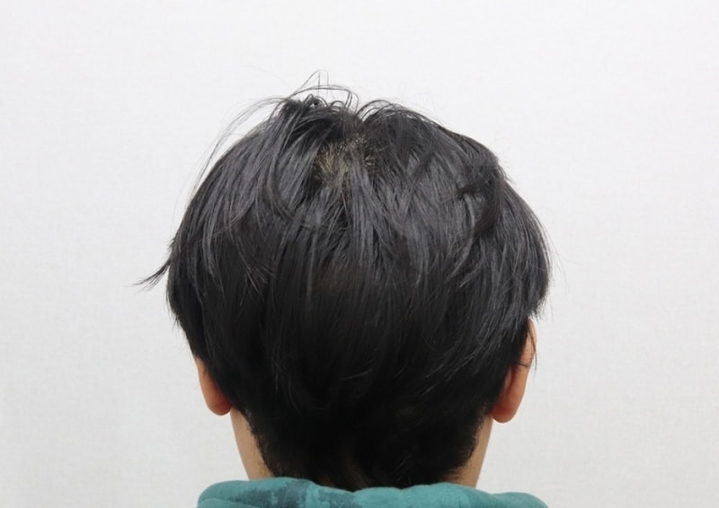5_후두부.jpg