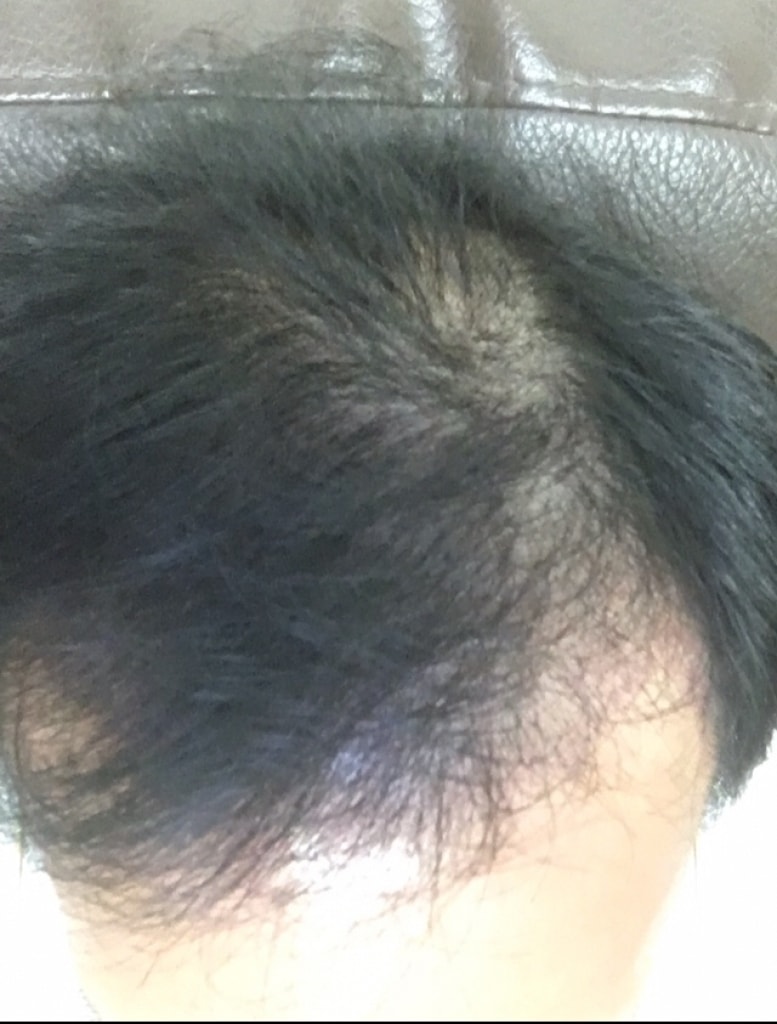 KakaoTalk_20180316_172331961.jpg