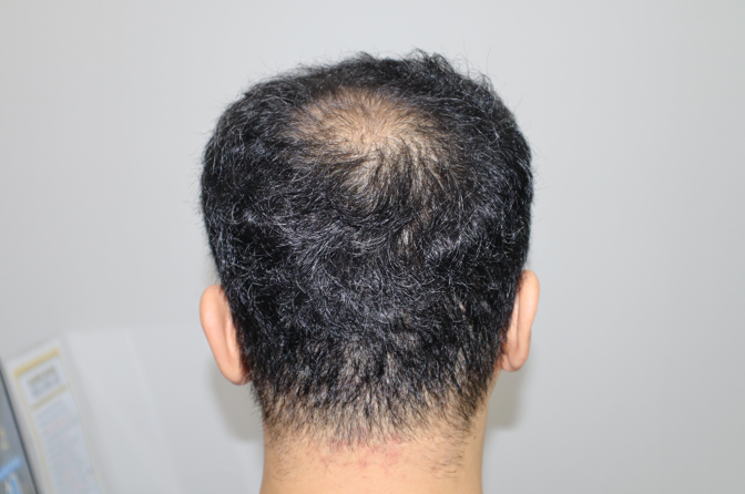 ヘアロ医院の全州ピジョルゲレビュー