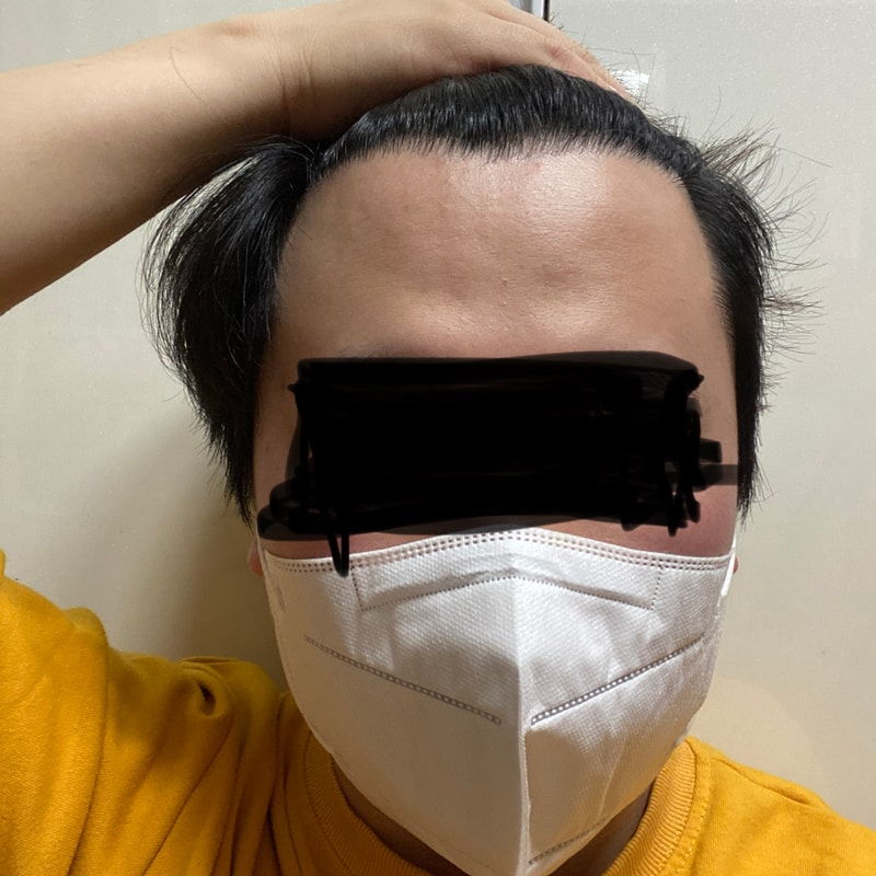 毕业的Dana整形外科主持人 10个月后期