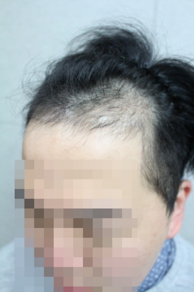 꾸미기_크기변환_IMG_2271.JPG