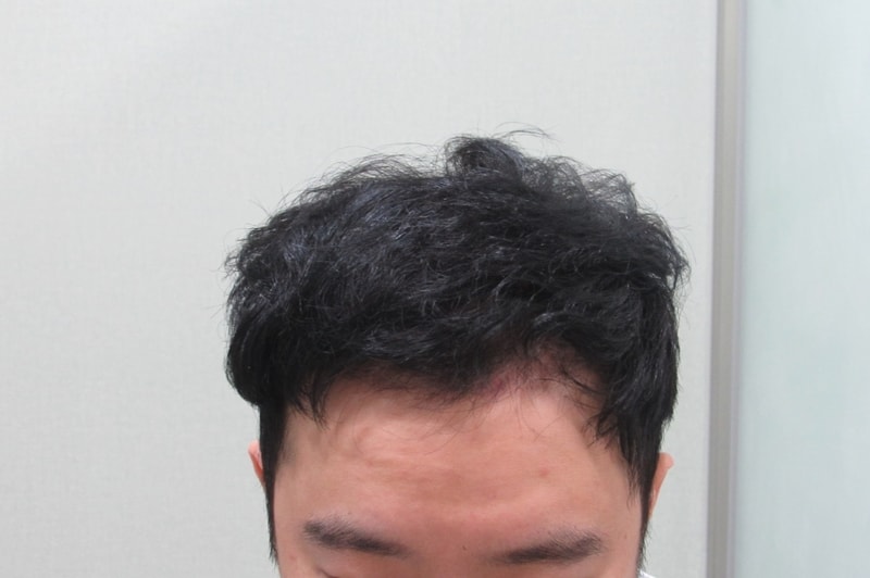 4개월.jpg