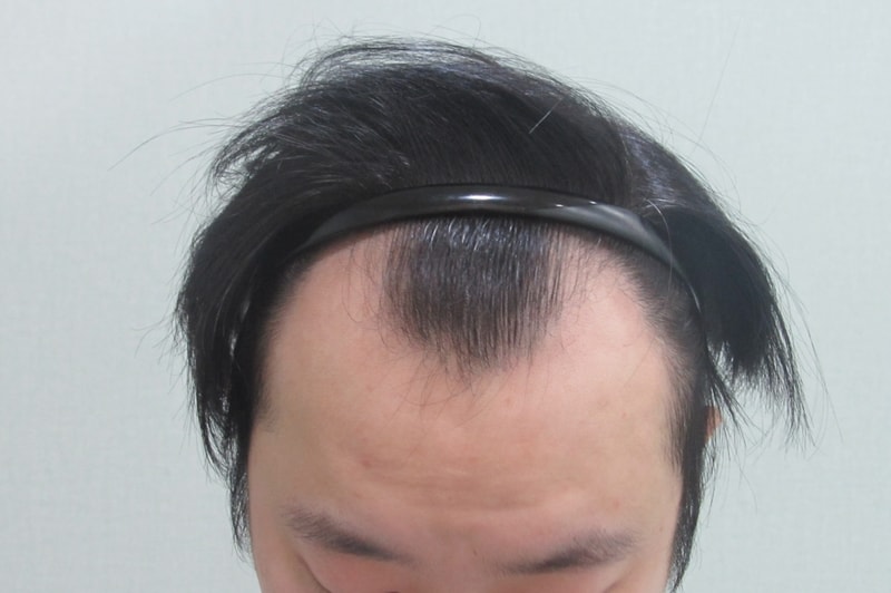 수술전1.jpg