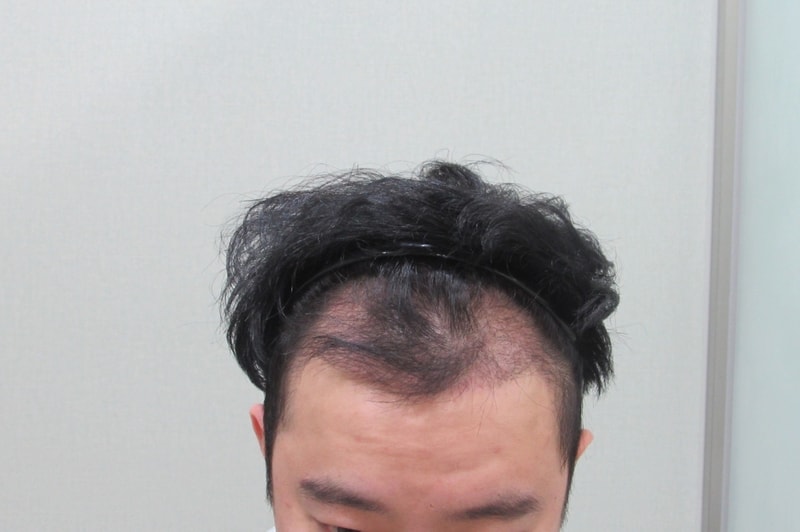 3개월.jpg