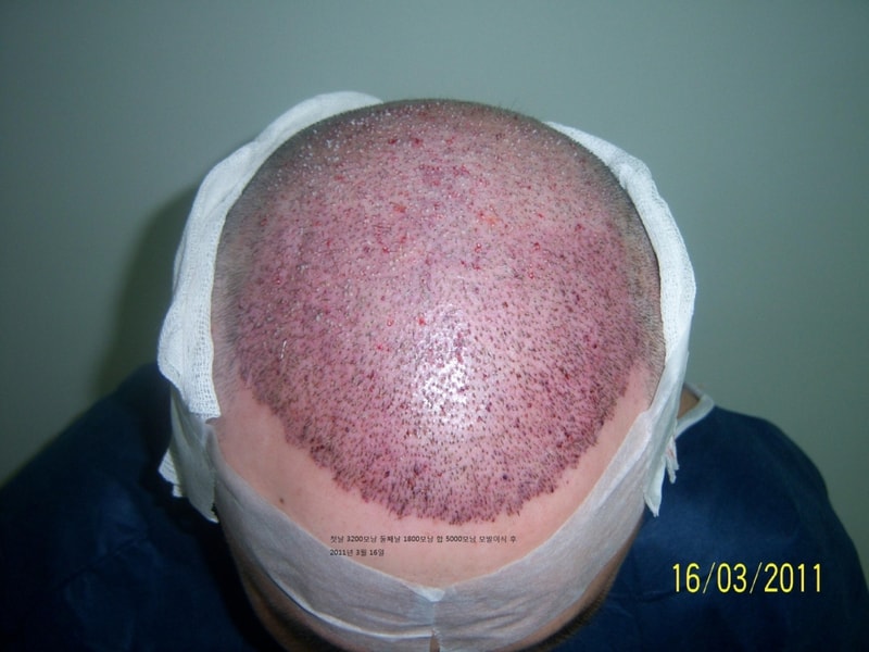 20110316.jpg
