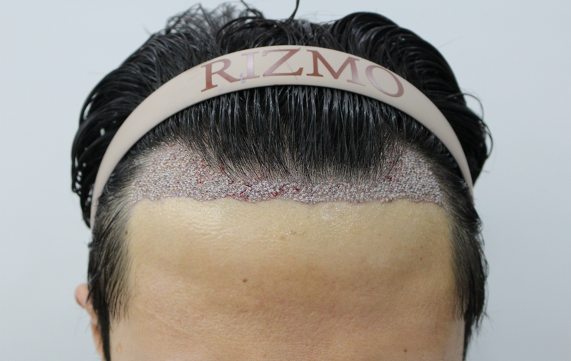 220221_수술후.png