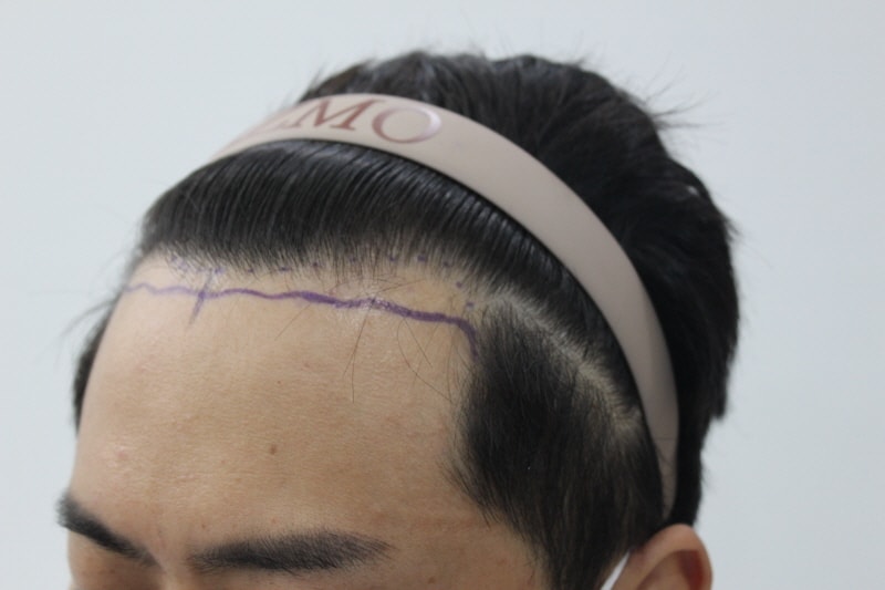 [크기변환]디자인후2.jpg