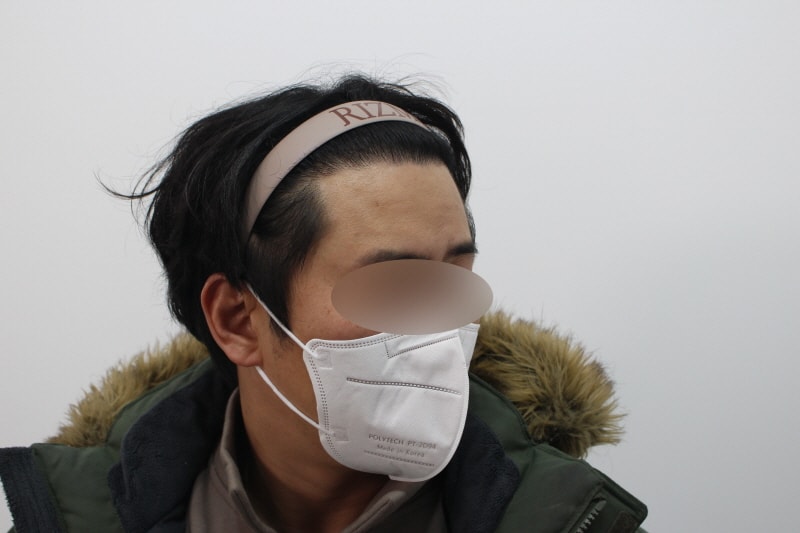 [크기변환]수술후 8개월차 측면s.jpg