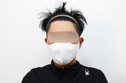 [크기변환]수술후 9개월차dd.jpg