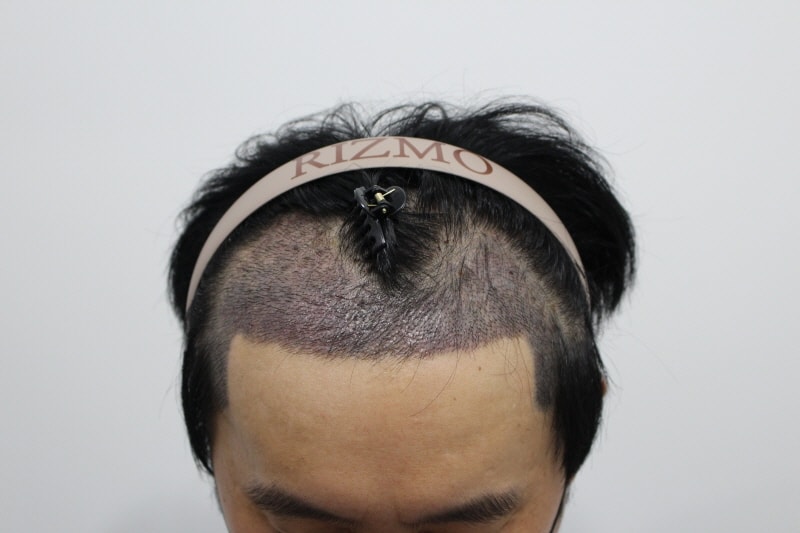 ㄱss[크기변환]20230725_143255_322.jpg