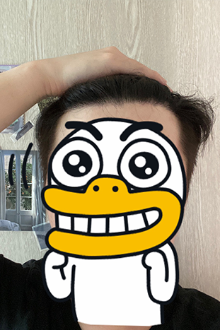 부산-리즈모-수술후-8개월차에-파인부위-깔끔하게-찼음..png