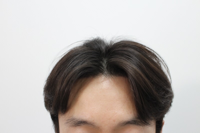 [크기변환]4개월후4.jpg
