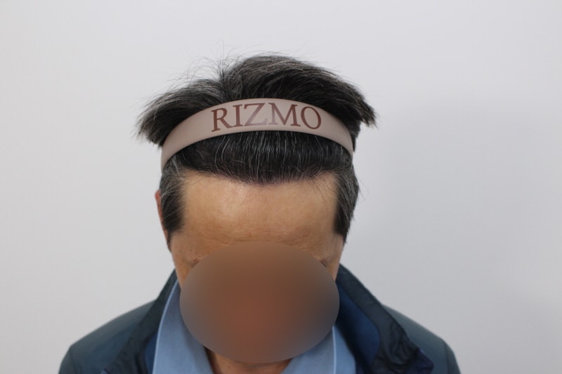수술후.jpg