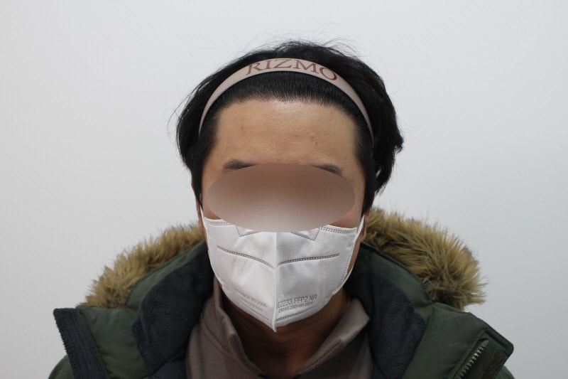 [크기변환]수술후 8개월차dd.jpg