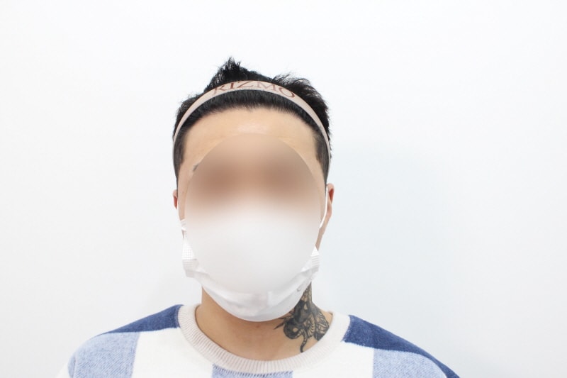 [크기변환]수술 8개월차.jpg