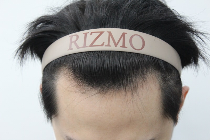 m-shaped 2200 Mo 4th month review (non-cut)