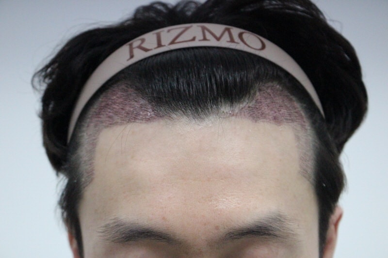 [크기변환]2주후1.jpg