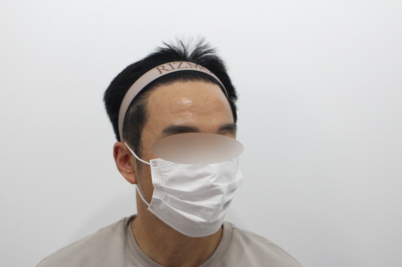 2[크기변환]수술후 240일차 2f.jpg