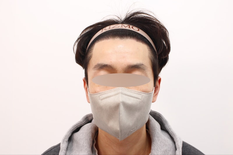 블러수술 후 8개월차.jpg
