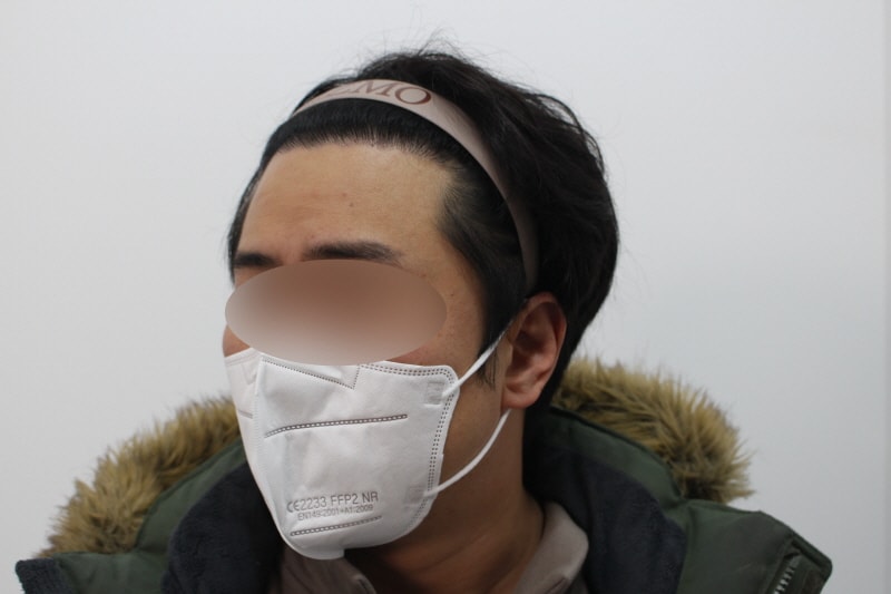 [크기변환]수술후 8개월차 측면1d.jpg