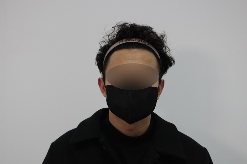 [크기변환]수술후1년차-앞모습XA.jpg