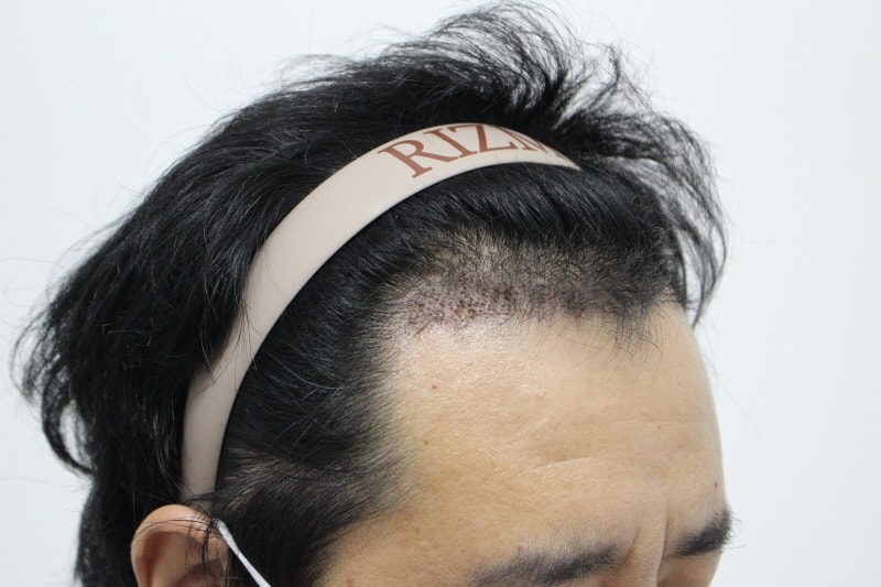 ㄱ[크기변환]20230713_154244_648.jpg