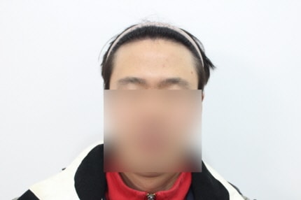 [크기변환]1년차 눈썹나오게 가려주세요s.jpg