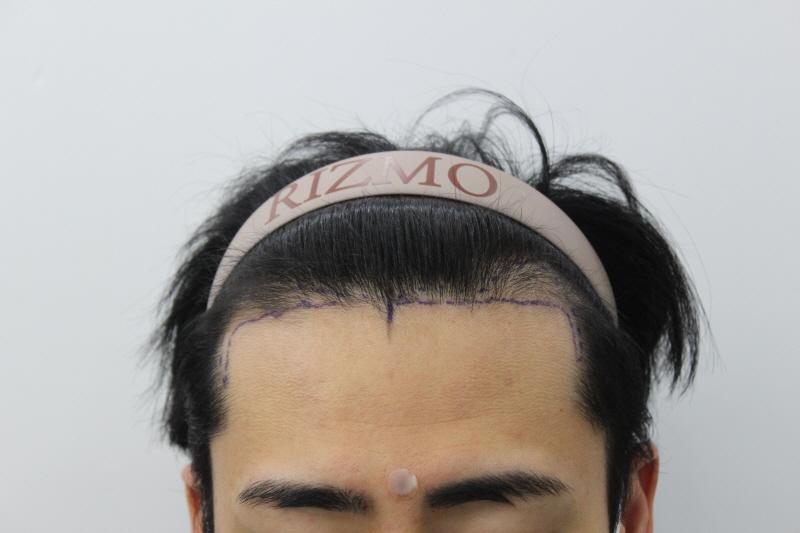在釜山Lizmo 1200顶 11个月大的样子~