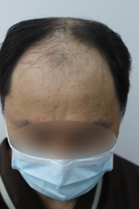 수술전2.jpg