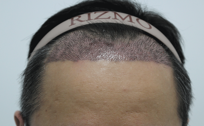 2주.png