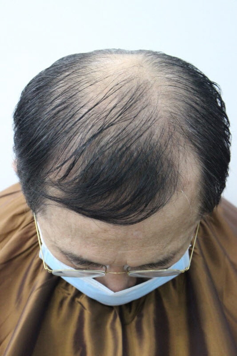 [크기변환][크기변환]수술전.jpg