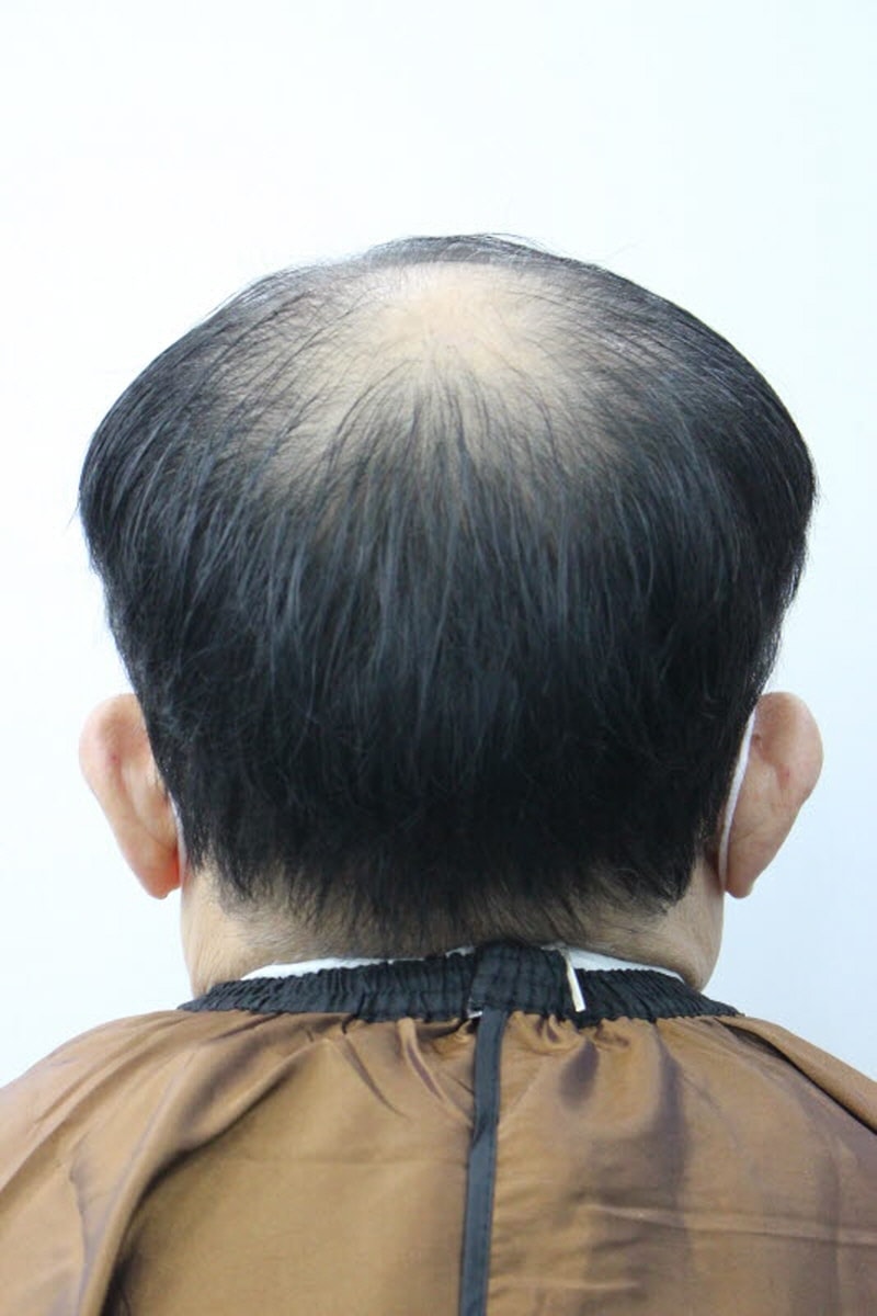 [크기변환][크기변환]수술전1.jpg
