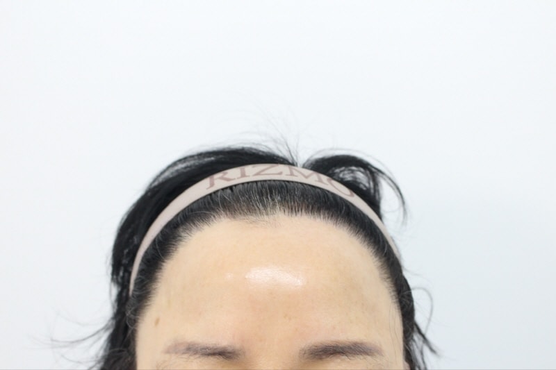 [크기변환]12개월후.jpg