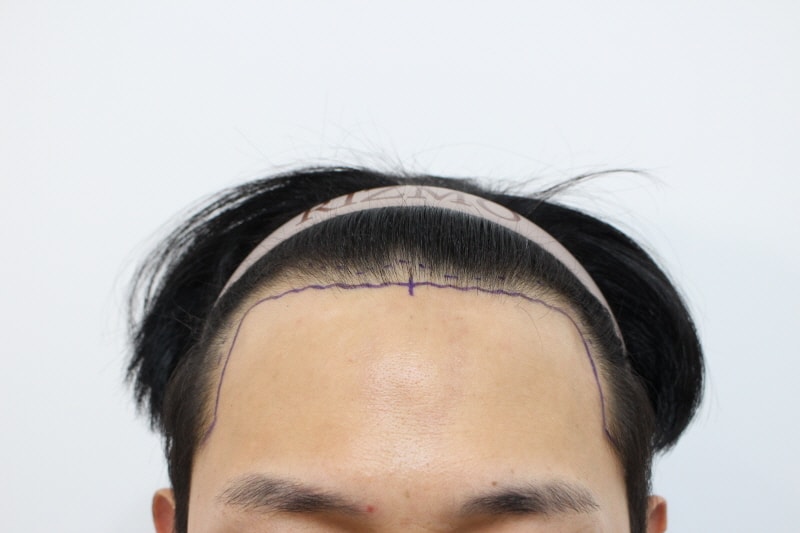 5. 디자인후.jpg