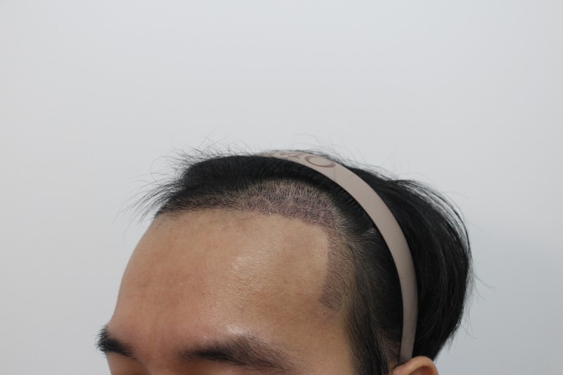 2[크기변환]2주 후.jpg