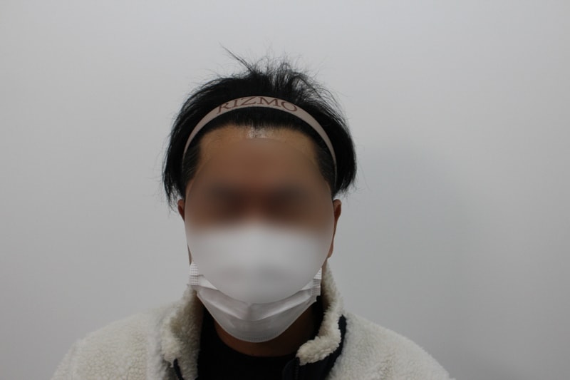 [크기변환]8개월 경과.jpg