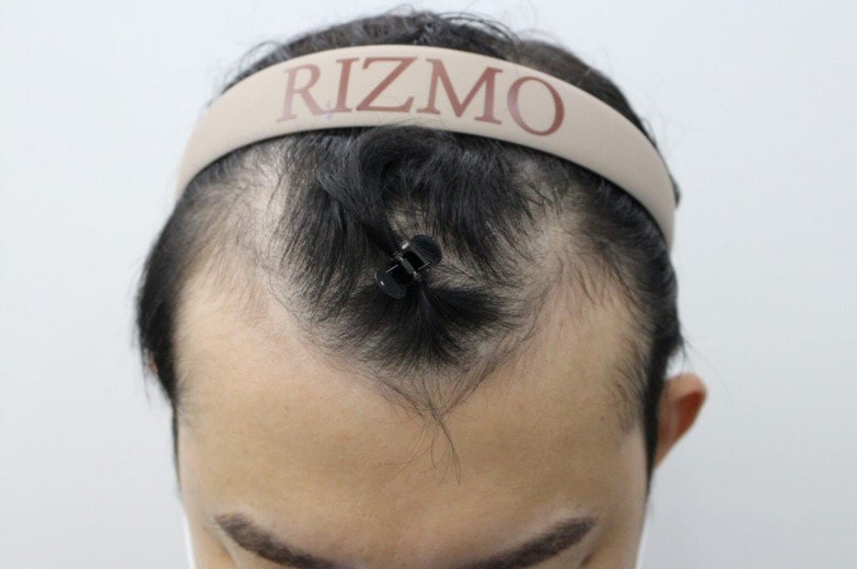 Men's non-cut 7000 Mo 8 Months Late (Full Shaved)