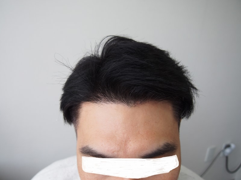 This is the 119th day of the parent plastic surgery clinic 2516 Mo.