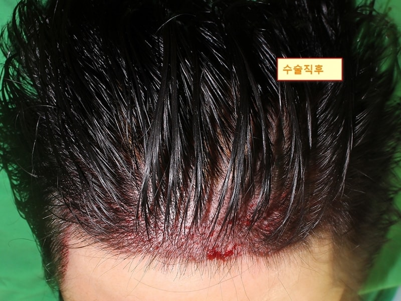 직후1.jpg