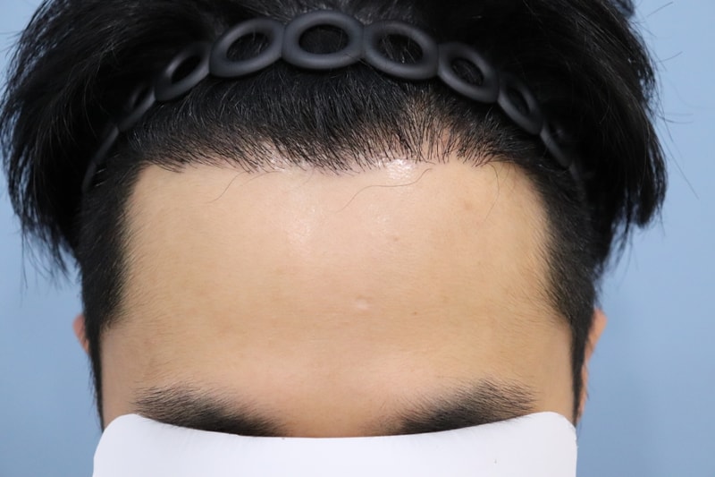 수술후2.jpg