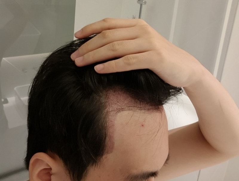 수술1일차2.jpg