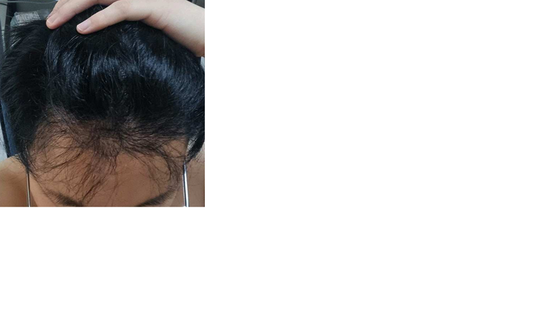 제목 없음.png