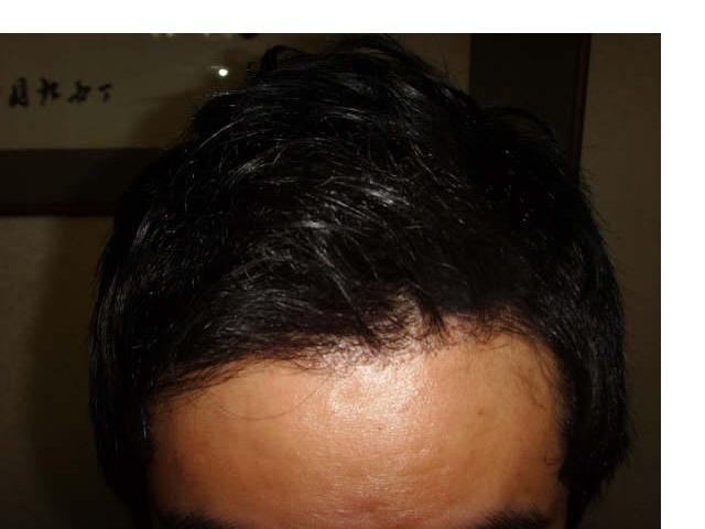 GetAttachment6.jpg