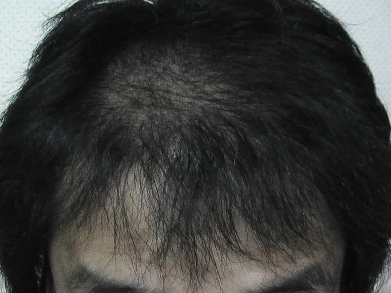 IMGA0318.JPG